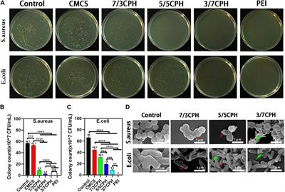 Antibacterial, injectable, and adhesive hydrogel promotes skin healing